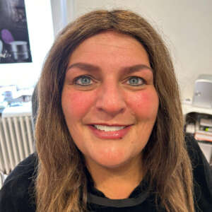 Full Face Gesichtsconturing mit Hyaluron, Lippenunterspritzung in Kombination mit Permanent Make Up nachher