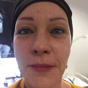 Gesichtsconturing nachher