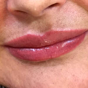 Korrektur von natürlichen asymetrischen Lippen mit Permanent Make Up und Hyaluron nachher