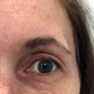 Korrektur von natürlichen asymetrischen Augenbrauen vorher